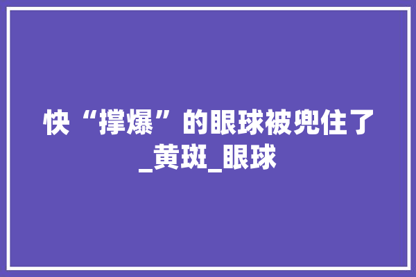 快“撑爆”的眼球被兜住了_黄斑_眼球